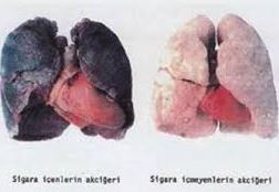 Sigara içenler akciğerlerini görmek ister mi ? (İzle & Paylaş)