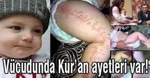 Çocuğun bedeninde ayetler yazıyor