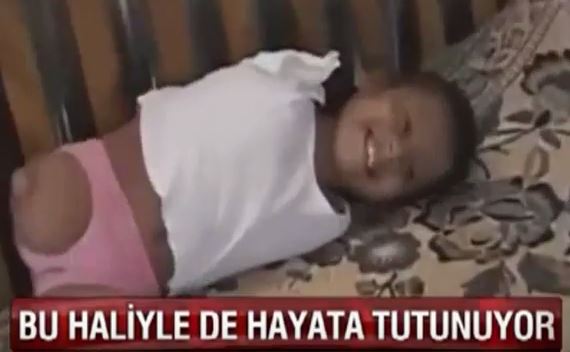 8 Yaşındaki Çocuğun Hayatla Mücadelesi